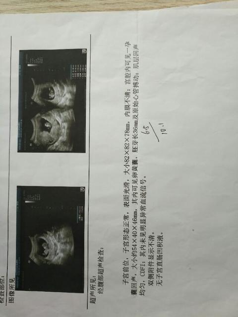 怀孕建档及住院流程是什么