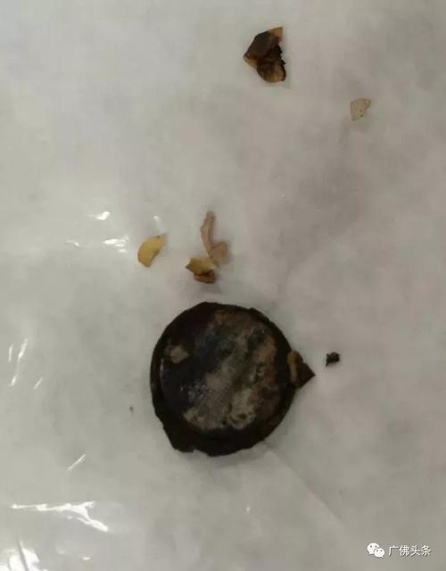 宝宝一吃饭就吐是怎么回事