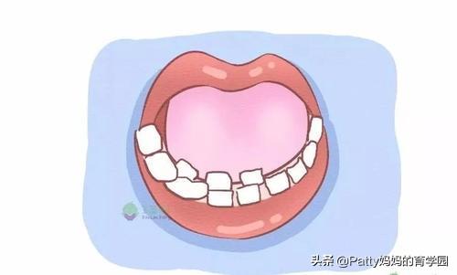 孩子长了双排牙怎么办
