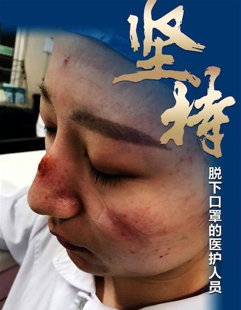 武汉抗击疫情中的感人瞬间