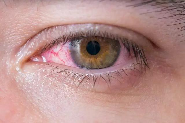 宝宝这些症状不一定是上火