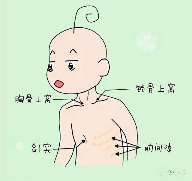 宝宝肺炎反反复复怎么办