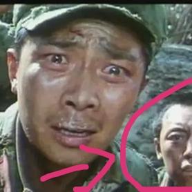 哈尔滨治疗面瘫的医院相关长尾关键词有哪些