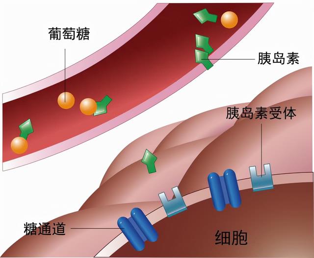 孕期妊娠糖尿病会容易饥饿吗