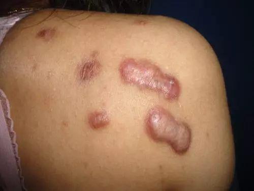 医学放射学杂志参考文献格式要求医学影像技术的就业前景如何