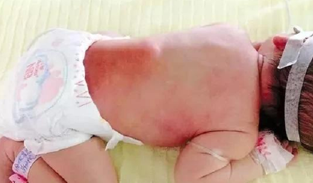 夏天可以给宝宝睡凉席吗