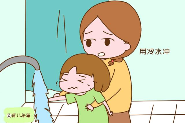 孩子烫伤后抹牙膏效果好吗