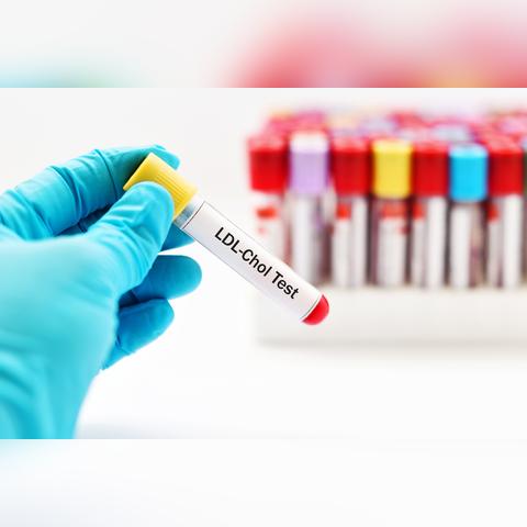 脂必妥与血脂康区别？