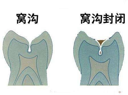 宝宝牙齿萌发期是什么时候