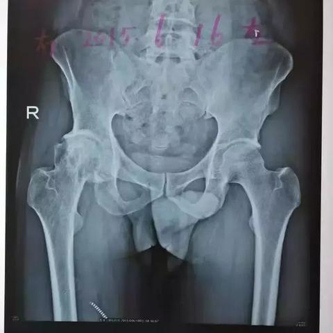 合肥市哪个男性医院好