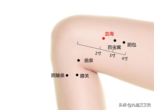 宝宝湿疹高发期