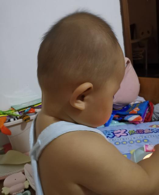 孩子头型偏了会影响宝宝吗