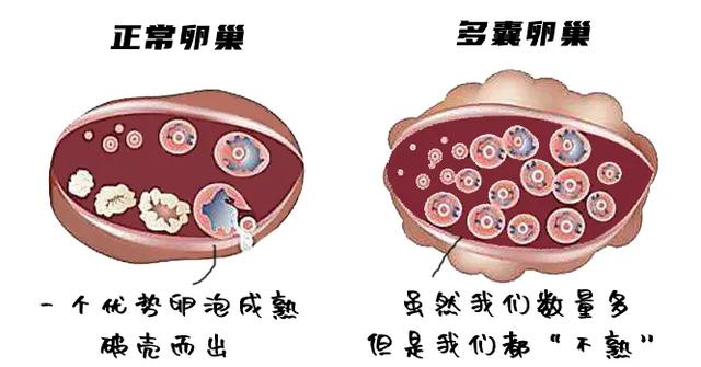 怀孕时得了妇科病怎么办