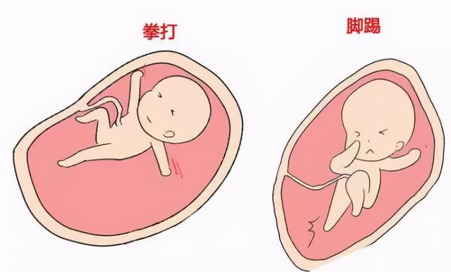 胎动异常是胎儿在求救