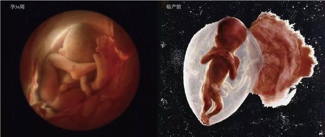 胎儿头大身子小什么原因