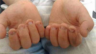 宝宝总是爱打人 宝宝总是爱打人