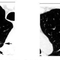 查ct报告单网上怎么查？