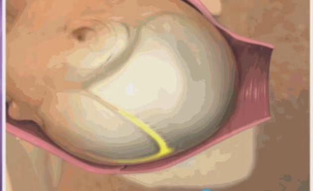 分娩前会有哪些征兆