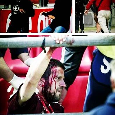 足球运动员黑面罩是谁的长尾关键词有哪些