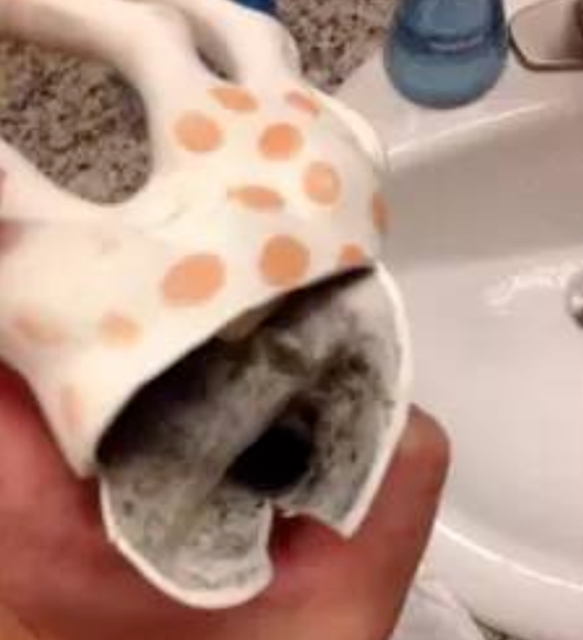 孩子总是在腹泻是什么原因