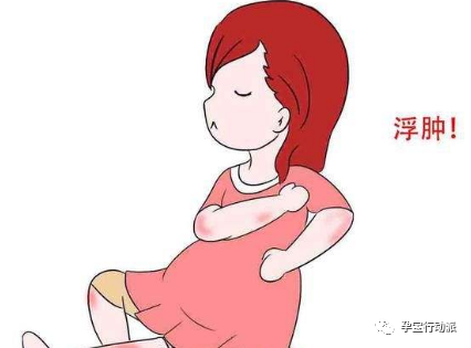你知道这5个日常减缓孕期浮肿的妙招吗