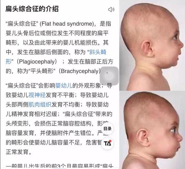 宝宝偏头正常吗 宝宝偏头正常吗