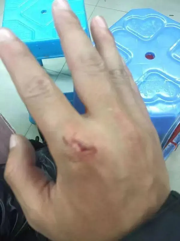 外卖餐盒有毒吗 外卖餐盒可以微波炉加热吗