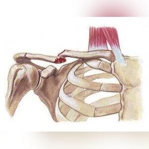 足球运动员的腿部骨骼图的长尾关键词有什么