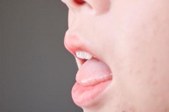 咀嚼经常咬到舌头，真的是嘴馋吗？告诉你科学的解释是什么
