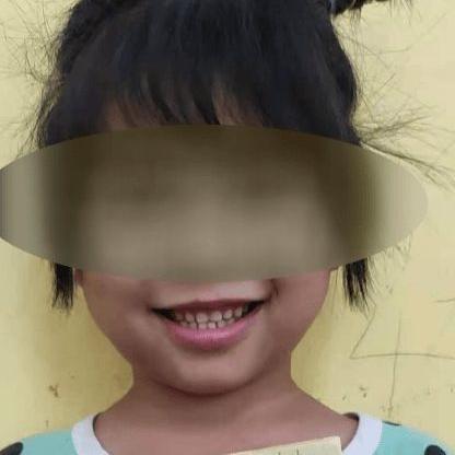 南宁市哪家医院拔牙好而且便宜？