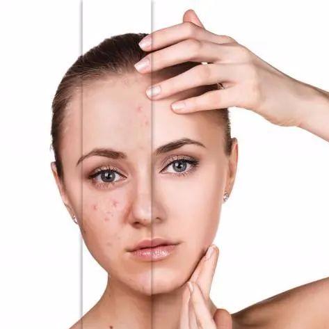 微商终身面膜骗局的长尾关键词有什么