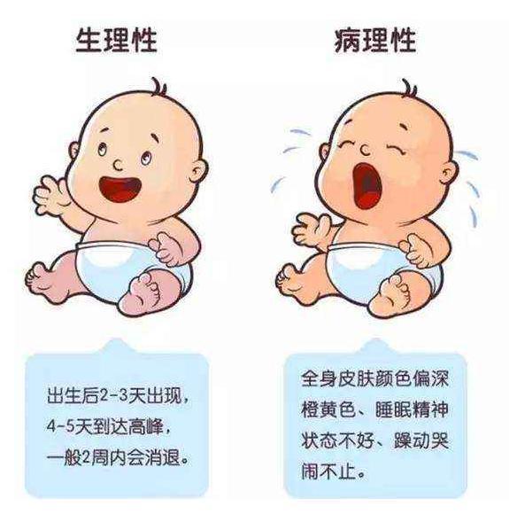 新生儿小腿弯曲是正常的吗