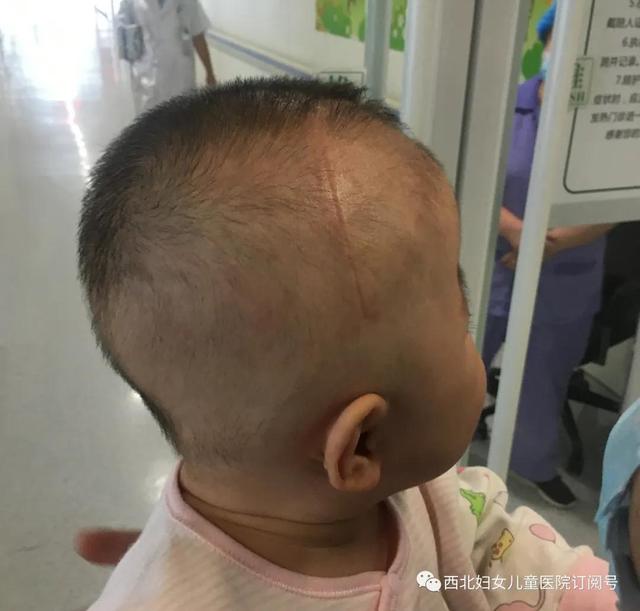 孩子什么头型好看女