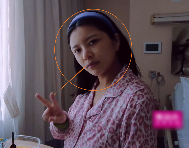 产后如何去除黑眼圈 产后如何去除黑眼圈