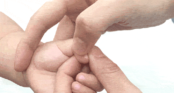 小儿疳积和积食一样吗 小儿疳积和积食一样吗