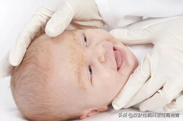 宝宝不同季节护理要点须知