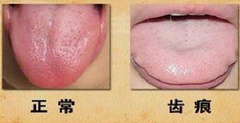 内心敏感的人有什么表现