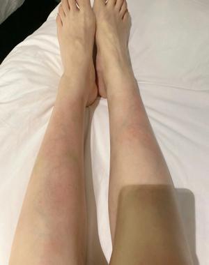 郭美美自曝5年狱中生活，曾神经衰弱腿上长满皮癣，做生意还被骗