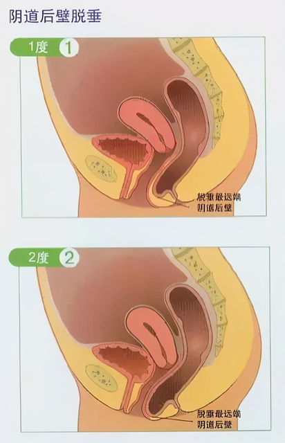 职场妈咪产后上班