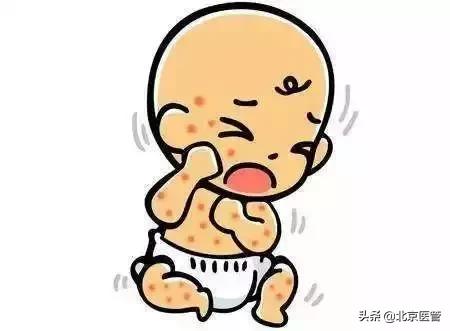孩子发水痘时的处理办法