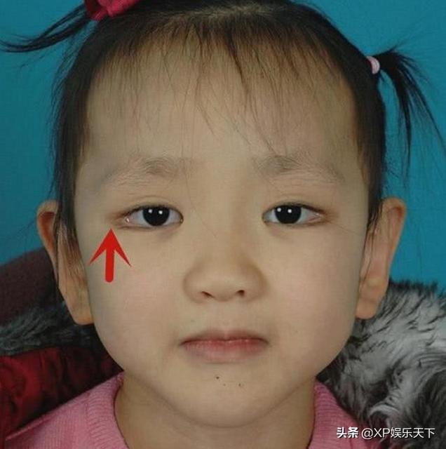 宝宝矮小症要检查什么项目