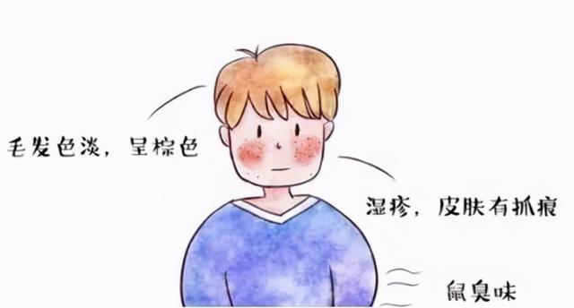 苯丙酮尿症（PKU）是什么遗传病