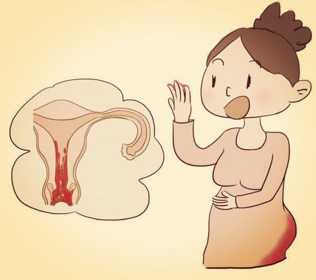 宫外孕腹痛位置图片图片