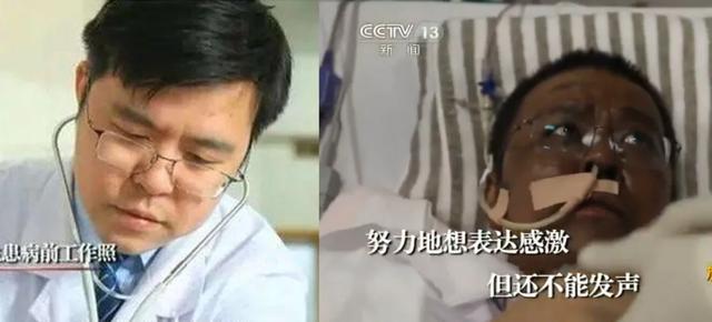 新冠肺炎重症患者治疗后皮肤变黑是怎么回事 新冠肺炎重症患者治疗后皮肤变黑是怎么回事