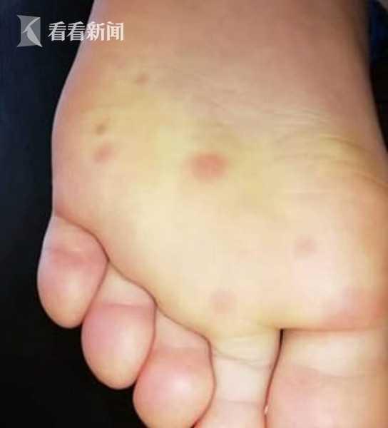 全世界的新冠病毒加起来有多重