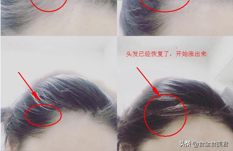 梦见别人掉头发