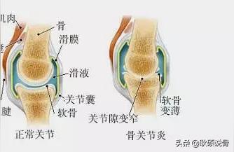 骨与关节杂志学术论文网我的论文是骨科方面的