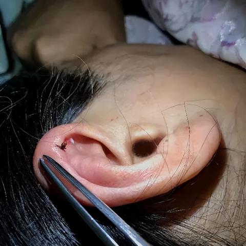 宁波市哪个医院看耳朵好