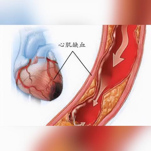 《深入了解：24小时动态心电图的工作原理与重要性》-第1张图片-其人生活百科