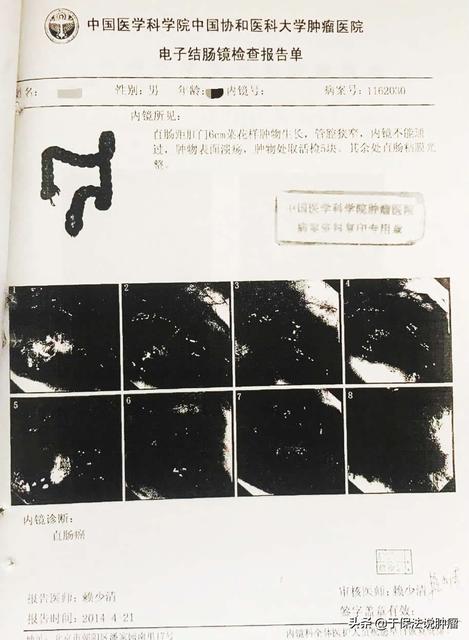 做一次肠镜能管多长时间